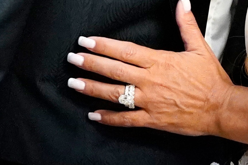 Teresa Giudice's engagement ring and wedding band