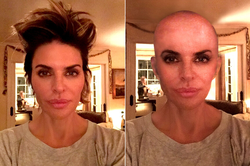 Lisa Rinna posts an edited photo of herself bald next to a photo of her with hair.