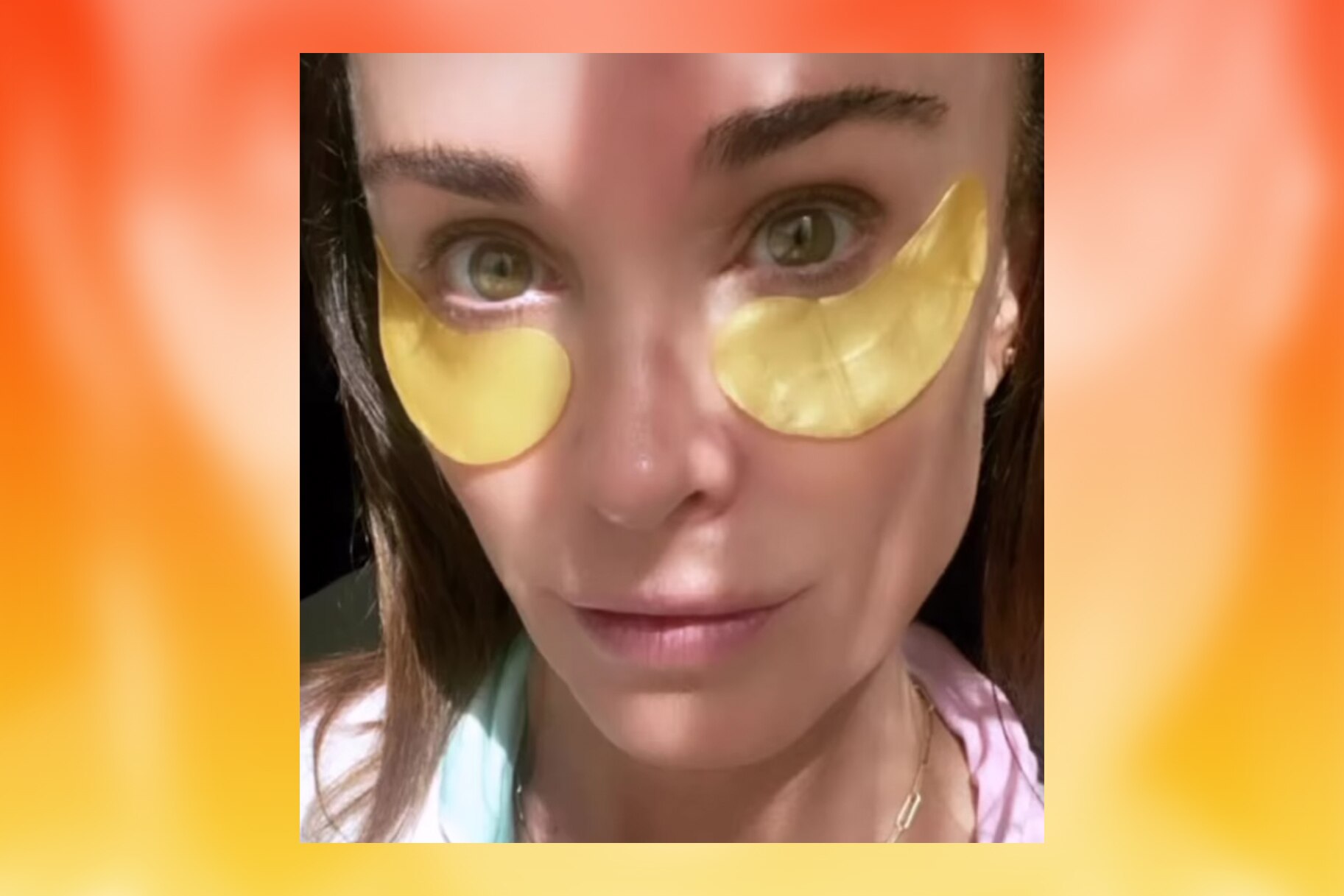 Kyle Richards Eye Patches