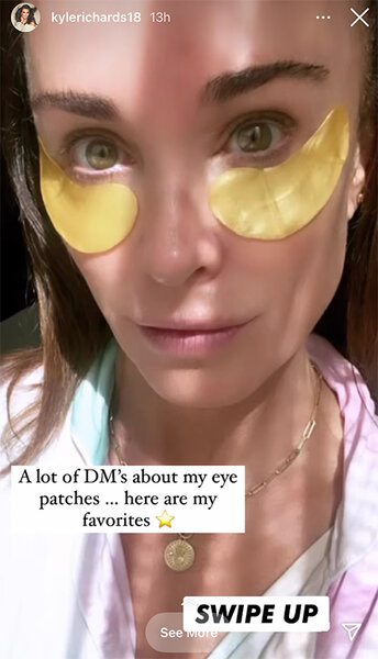Kyle Richards Eye Patches 1