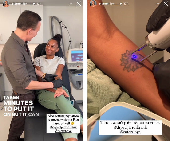 A split of Ciara Miller having a tattoo removed.