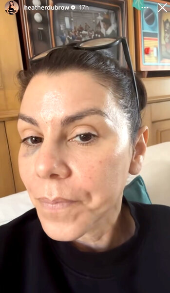Heather Dubrow shows the results of a facial treatment