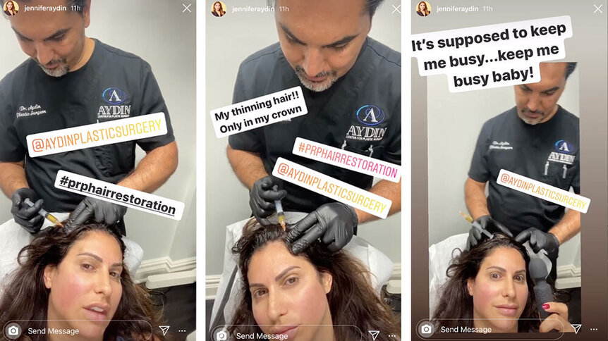 Jennifer Aydin Prp Hair Treatment 1
